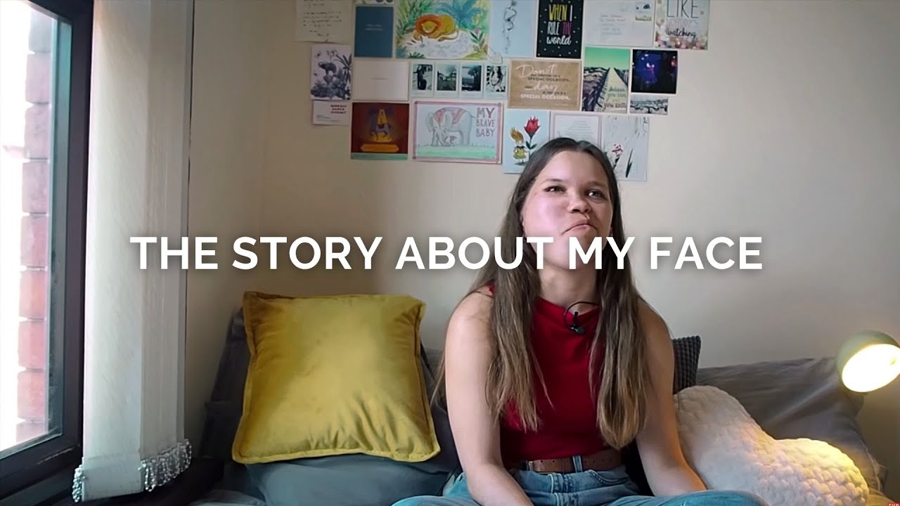 'I Was Born With a Facial Disfigurement' | PEOPLE