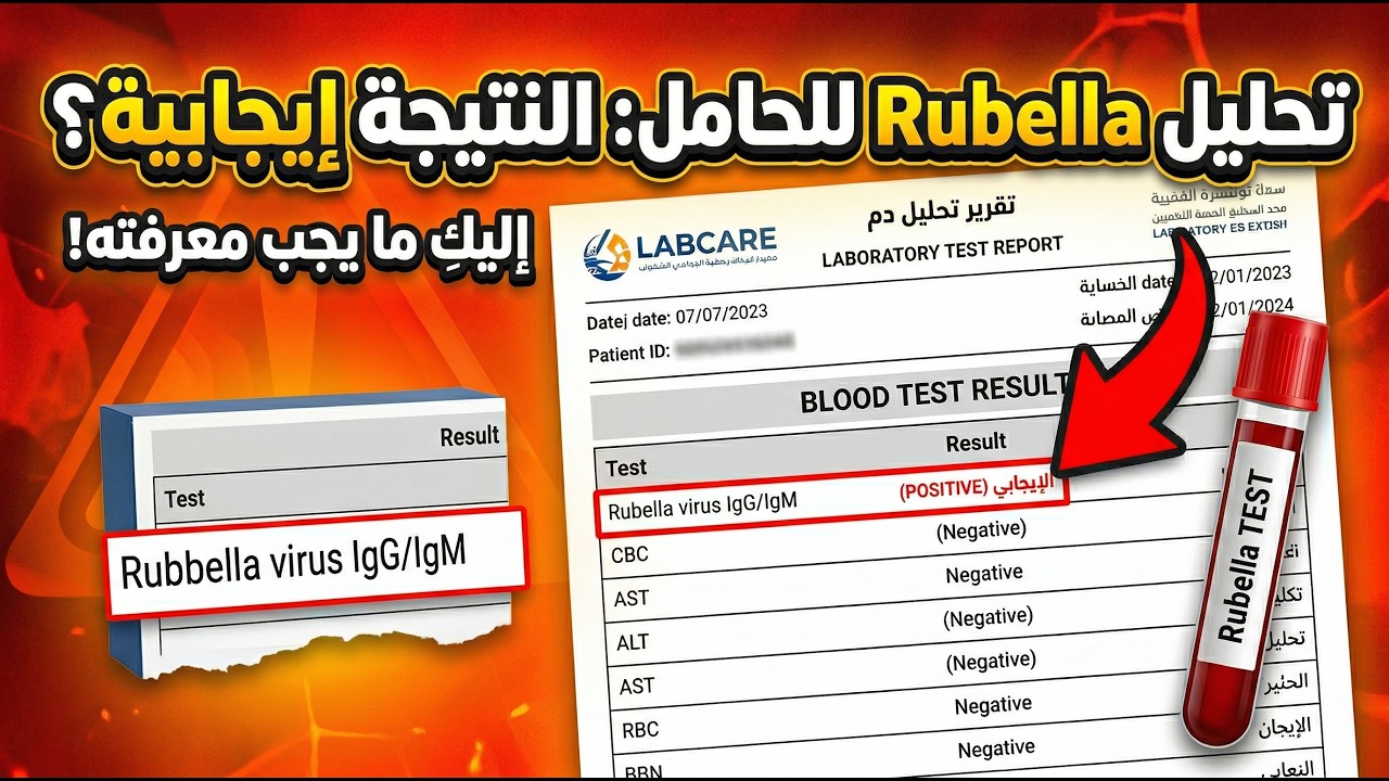 تحليل فيرس rubella (الحصبة الألماني) وتفسير النتائج وليه بيتطلب تعملة الحامل