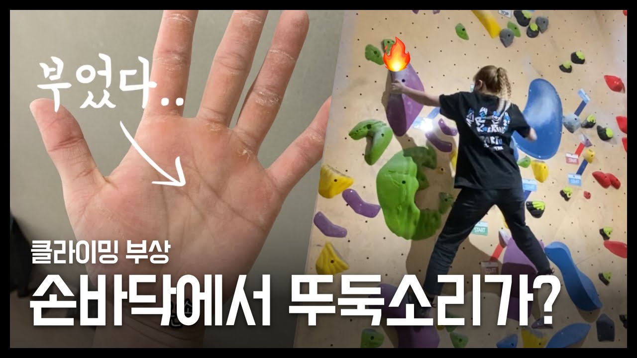 손바닥에서 뚜둑 소리가 났다면 🥺 최소 힘줄 부상입니다 / 클라이밍 / 볼더링 / 물리치료