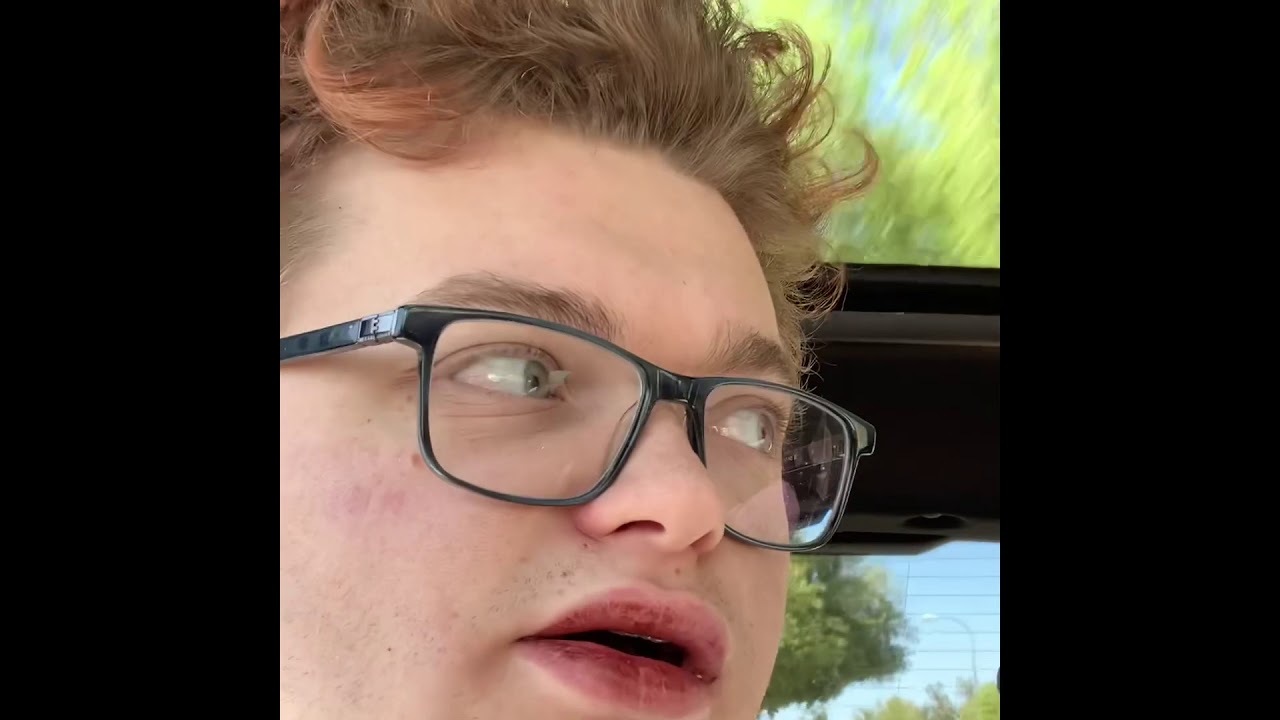 I got my wisdom teeth pulled