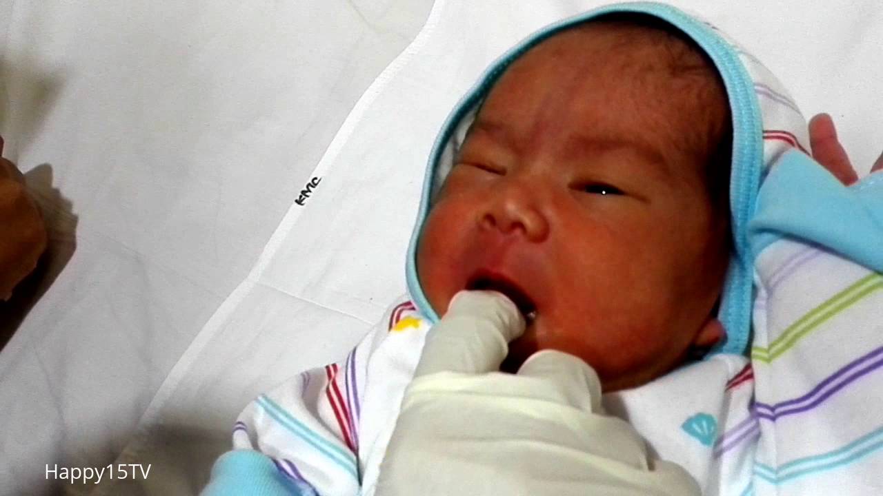 Senam Lidah Bayi Tongue Tie after frenotomi di Klinik Laktasi Kemang Medical Care