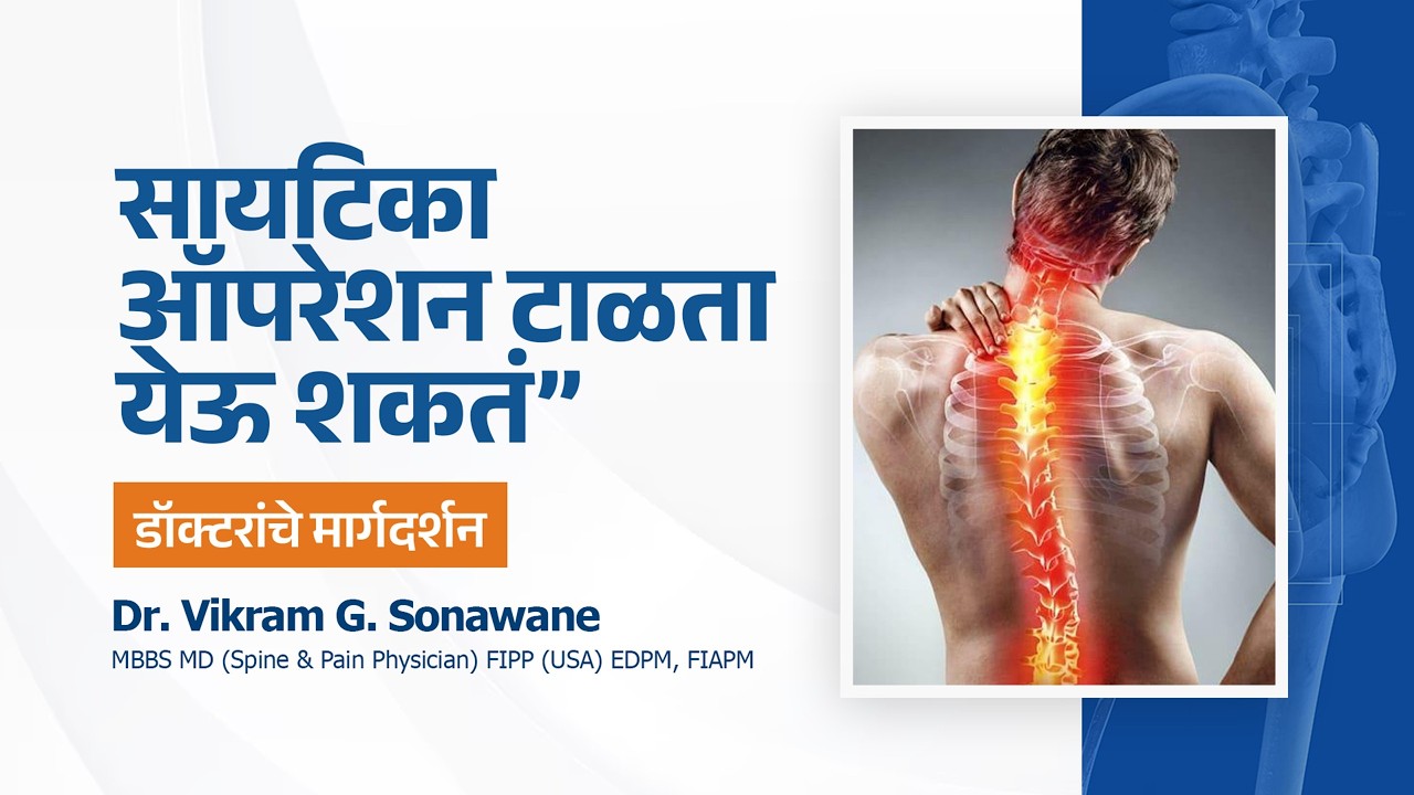 Sciatica Treatment Without Surgery? | Expert Advice by Dr. Vikram Sonawane