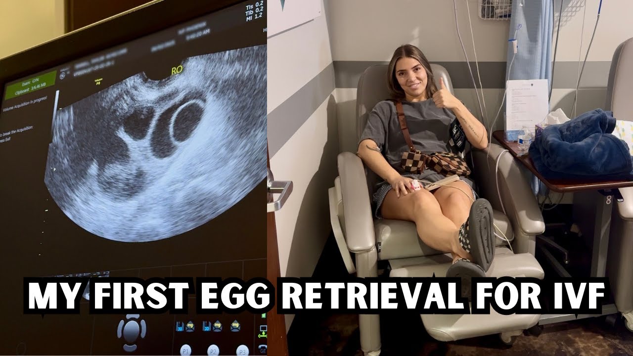 ITS EGG RETRIEVAL DAY!