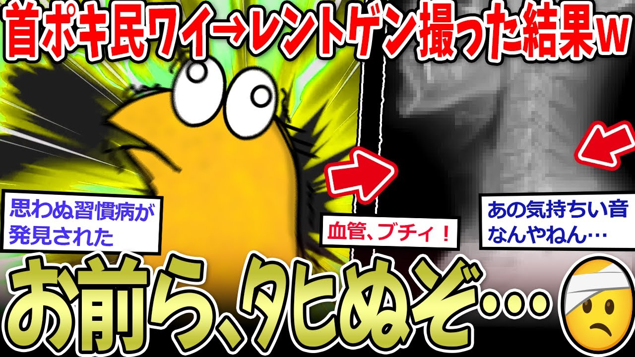 【危険】長年首ポキ民ワイ、ふとレントゲン撮った結果ｗｗｗ【2ch面白いスレ】