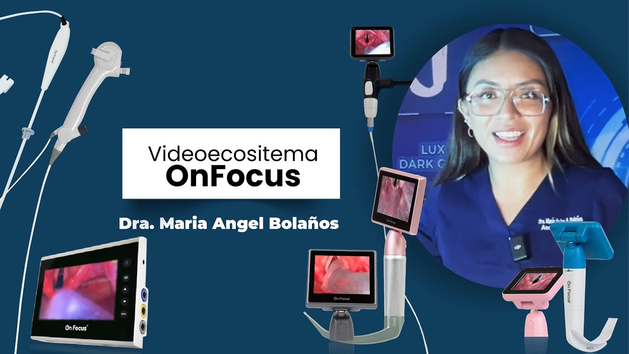 Videoecosistema OnFocus