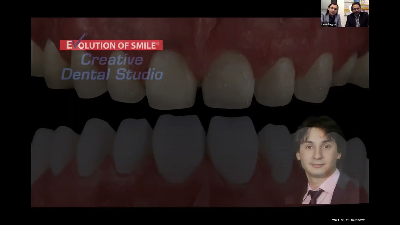 Digital Prosthetic Dentistry Online Short Course Day 2, Part 1