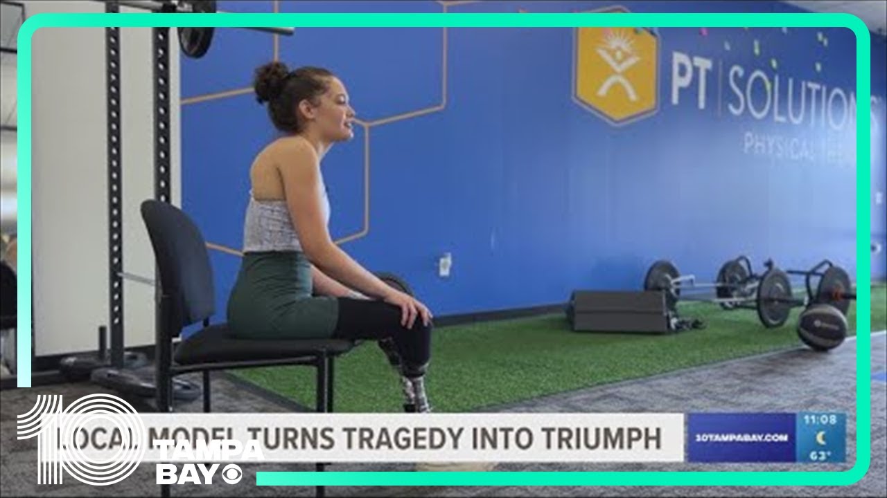 St. Pete model turns tragedy into triumph after becoming a double amputee due to COVID