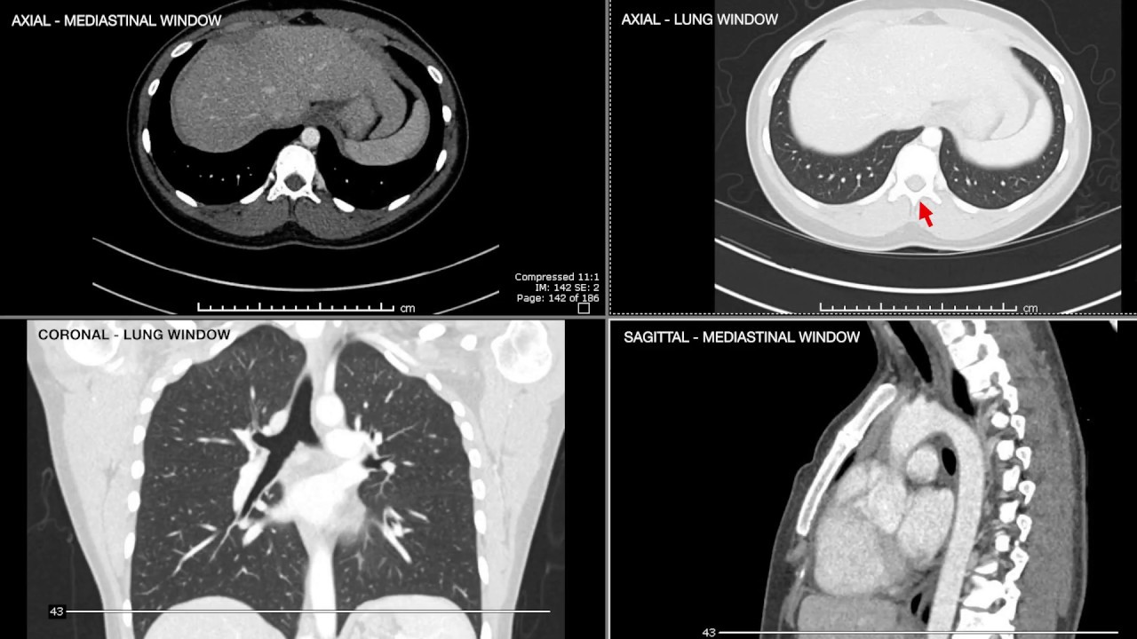 Introduction to Computed Tomographic imaging of the Chest