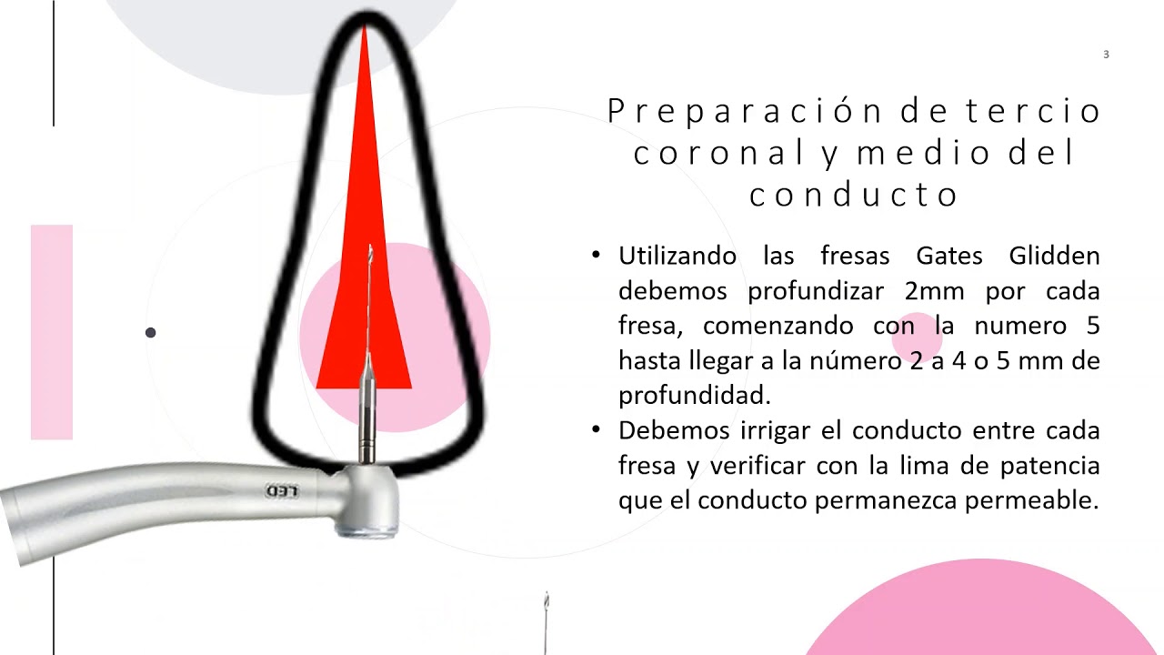 Técnica de Crown Down