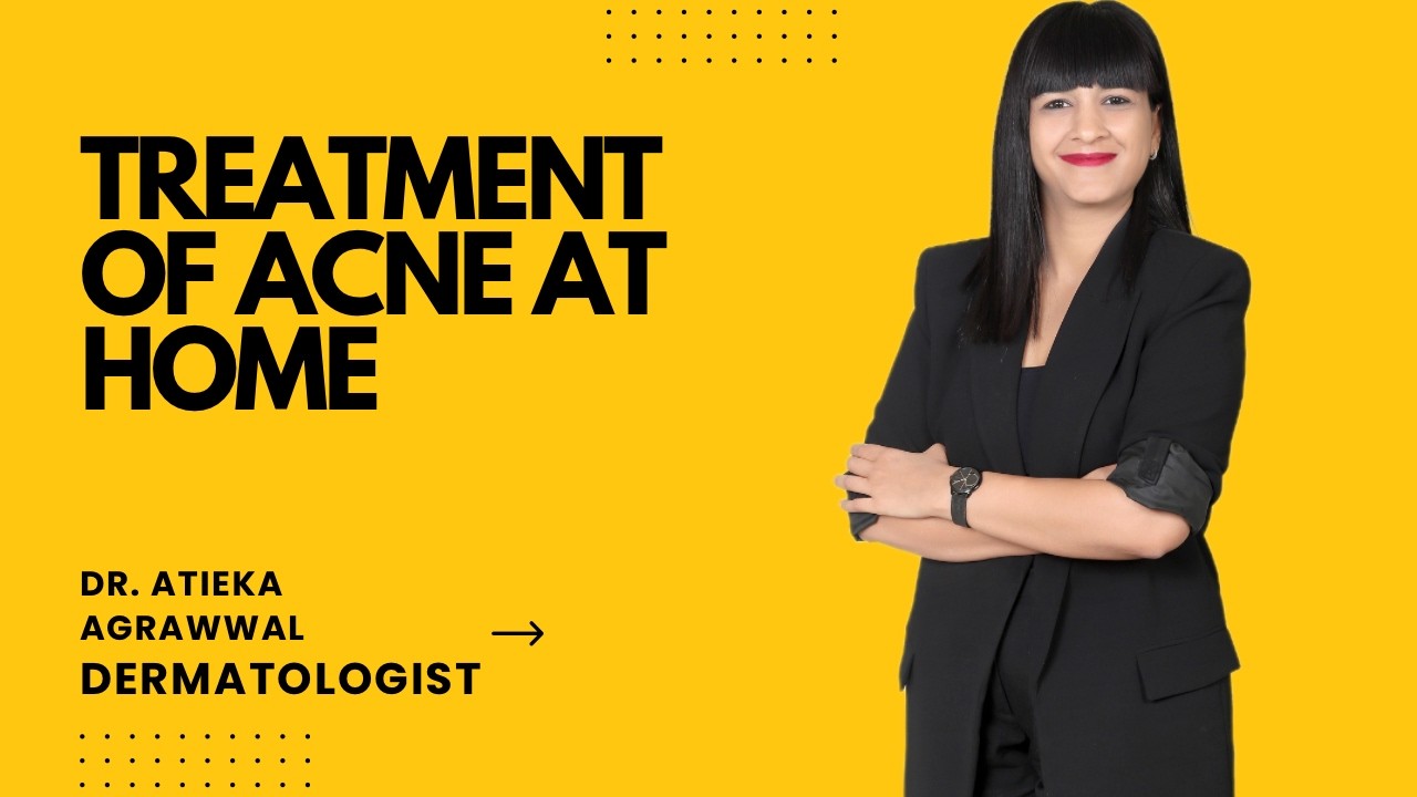 Acne/Pimples treatment at home | Pimples Kaise Hataye?