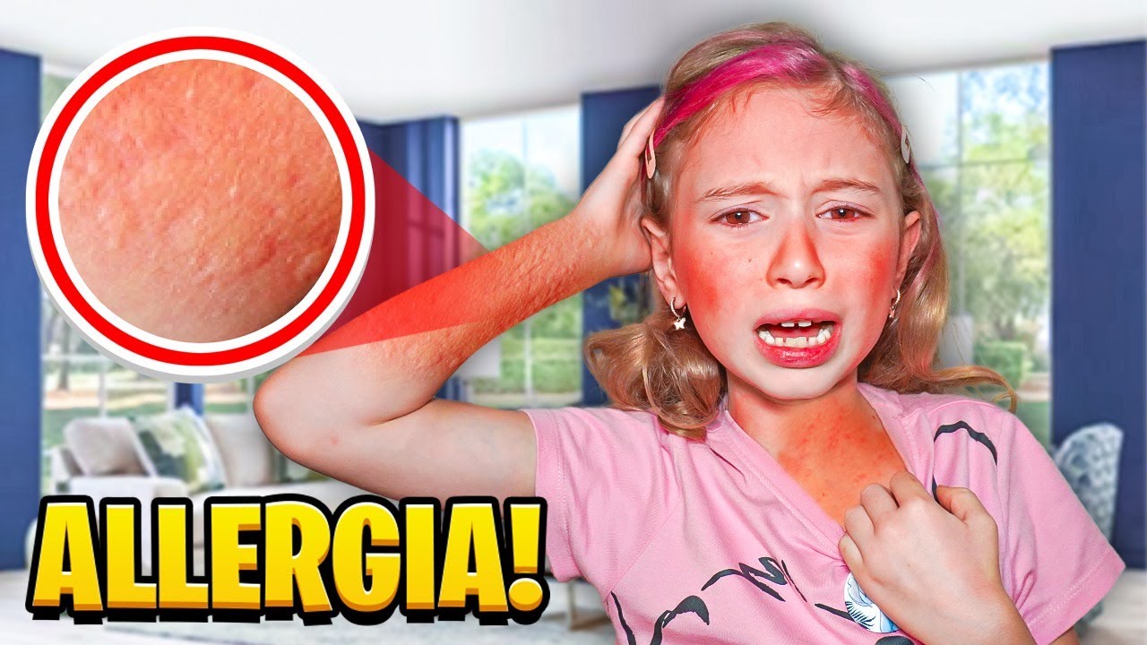GIORGIA HA AVUTO UNA REAZIONE ALLERGICA CON PAPÀ SALVO!  *ANDIAMO AL PRONTO SOCCORSO*