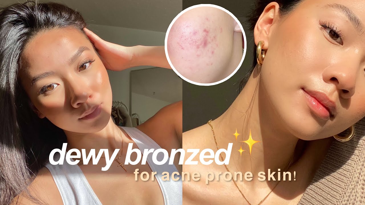 My Quick Natural Glow Makeup (acne-prone skin, dark acne scars) | Colleen Ho