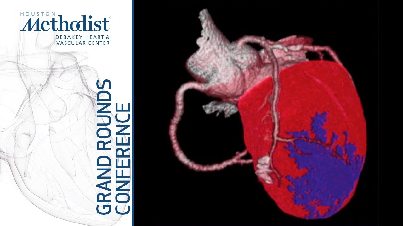 Transforming the Cardiovascular Care Pathway (Matthew Jay Budoff, MD) April 23, 2020