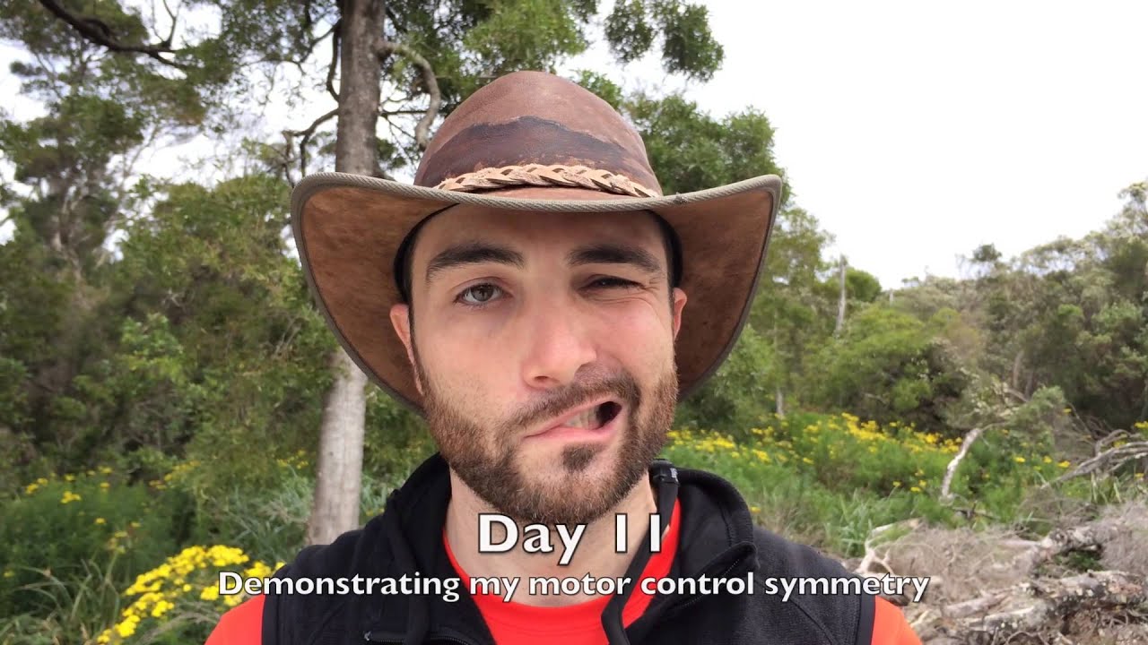 My Journey to Recovering from Bell's Palsy