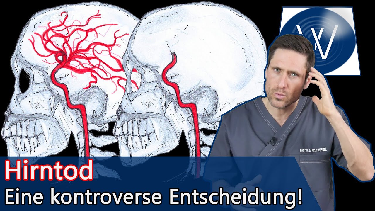Hirntod: Was genau bedeutet das & wirklich irreversibel? Mein Körper ist gesund aber mein Gehirn tot