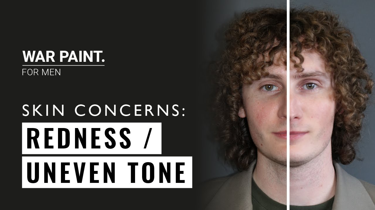 TACKLING COMMON SKIN CONCERNS | REDNESS & UNEVEN TONE