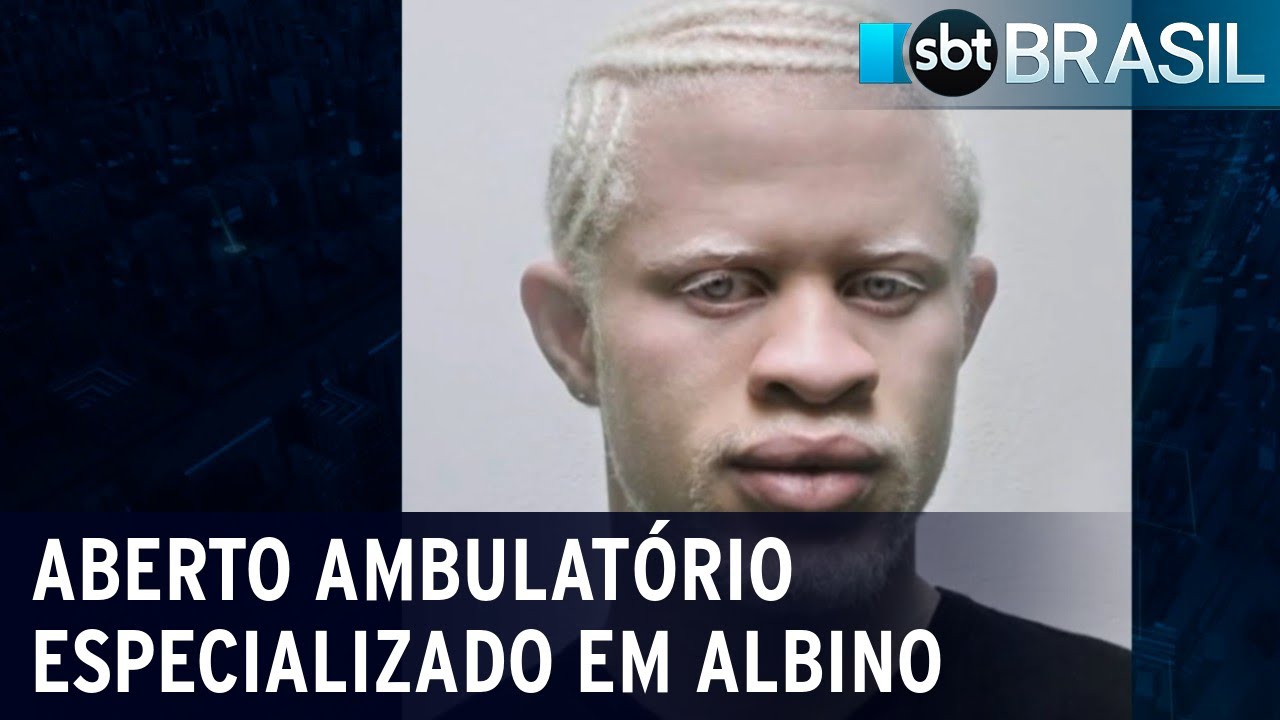 Primeiro ambulatório especializado em atender albinos é aberto em SP | SBT Brasil (03/12/20)
