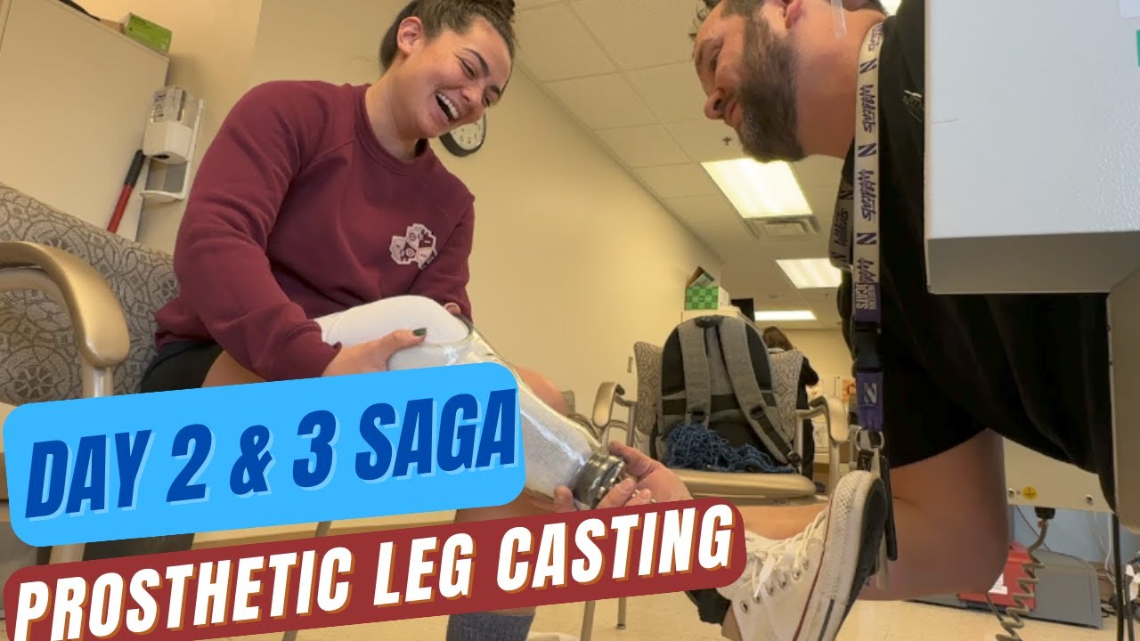 Day 2 & 3 Saga of Making a Prosthetic