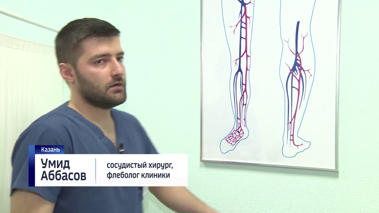 ВАРИКОЗА НЕТ Казань