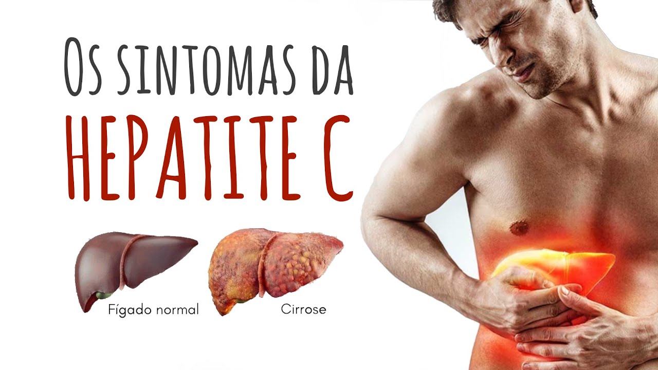 Os sintomas da Hepatite C