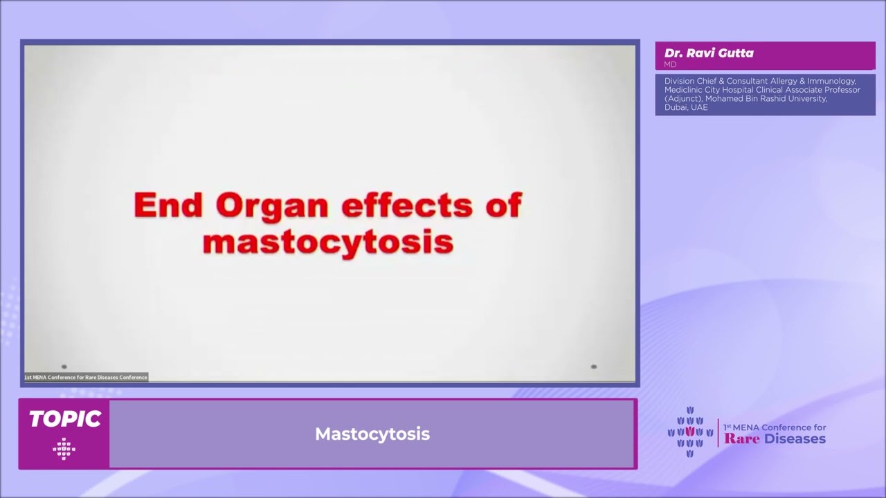 Dr. Ravi Gutta : Mastocytosis