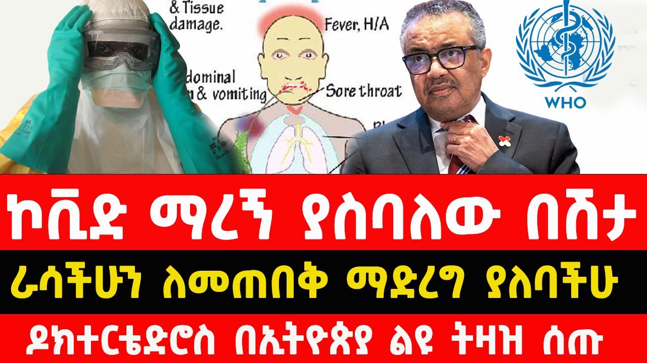 የሄሞራጂክ ፊቨር በሽታ ምልክቶችና መከላከያ መንገዶች | Hemorrhagic Fever in Ethiopia  symptoms and prevention | ጂንካ |