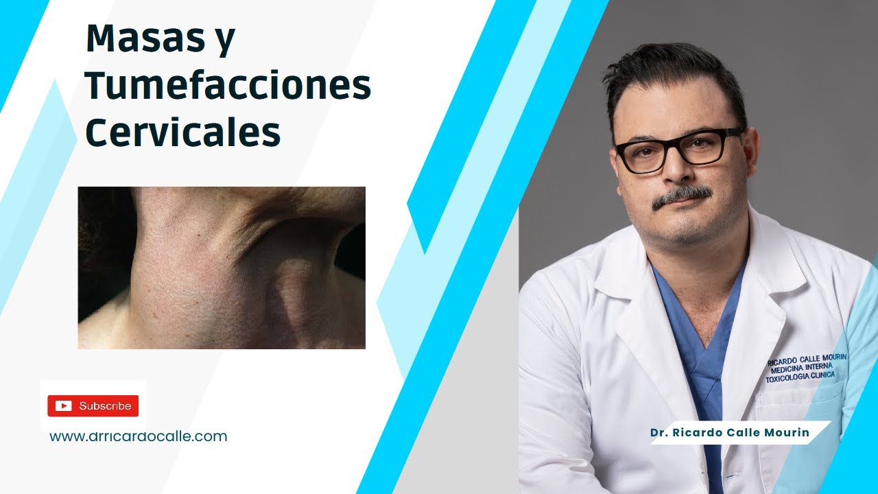 Masas y Tumefacciones en Cuello | Linfomas/Adenopatias