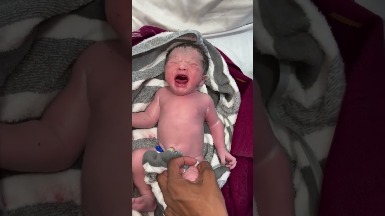 hepatitis B vaccination#newborn   #vaccin