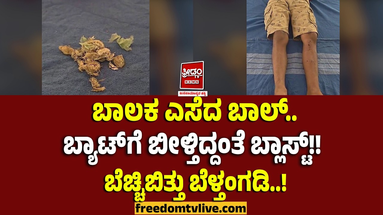 Mangalore Blast: ಬಾಲಕ ಎಸೆದ ಬಾಲ್.. ಬ್ಯಾಟ್ ಗೆ ಬೀಳ್ತಿದ್ದಂತೆ ಬ್ಲಾಸ್ಟ್!!ಬೆಚ್ಚಿಬಿತ್ತು ಬೆಳ್ತಂಗಡಿ..! |