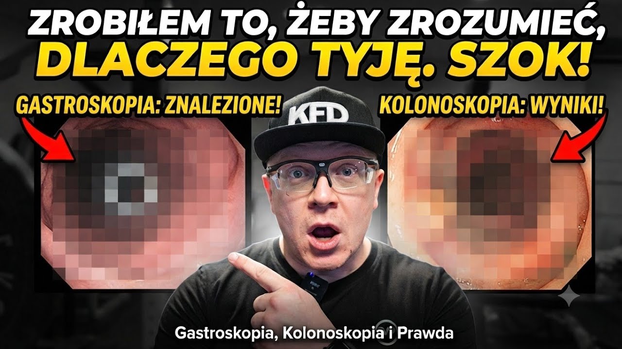 ZROBIŁEM TO, ŻEBY ZROZUMIEĆ, DLACZEGO TYJĘ. Kolonoskopia, gastroskopia i szokujące wnioski