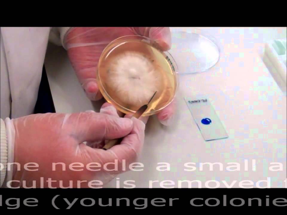 Microbiology: Lactophenol Cotton Blue Technique