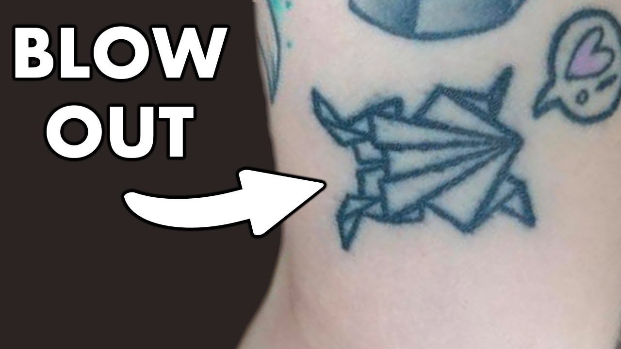 Can You Fix Tattoo Blowouts? - What You Should Know