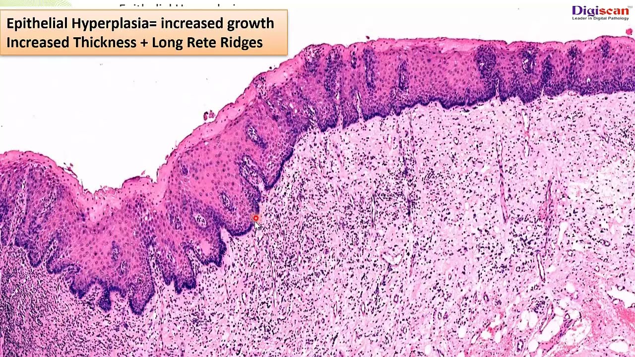 Terminology in Histopathology
