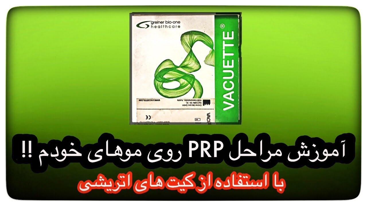 آموزش مراحل PRP روی مو های خودم
