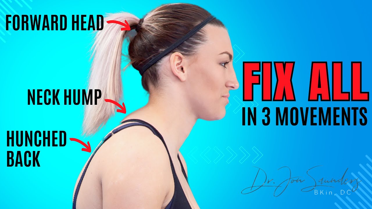 I Fixed My Neck Hump And Forward Head Posture In 30 Days!