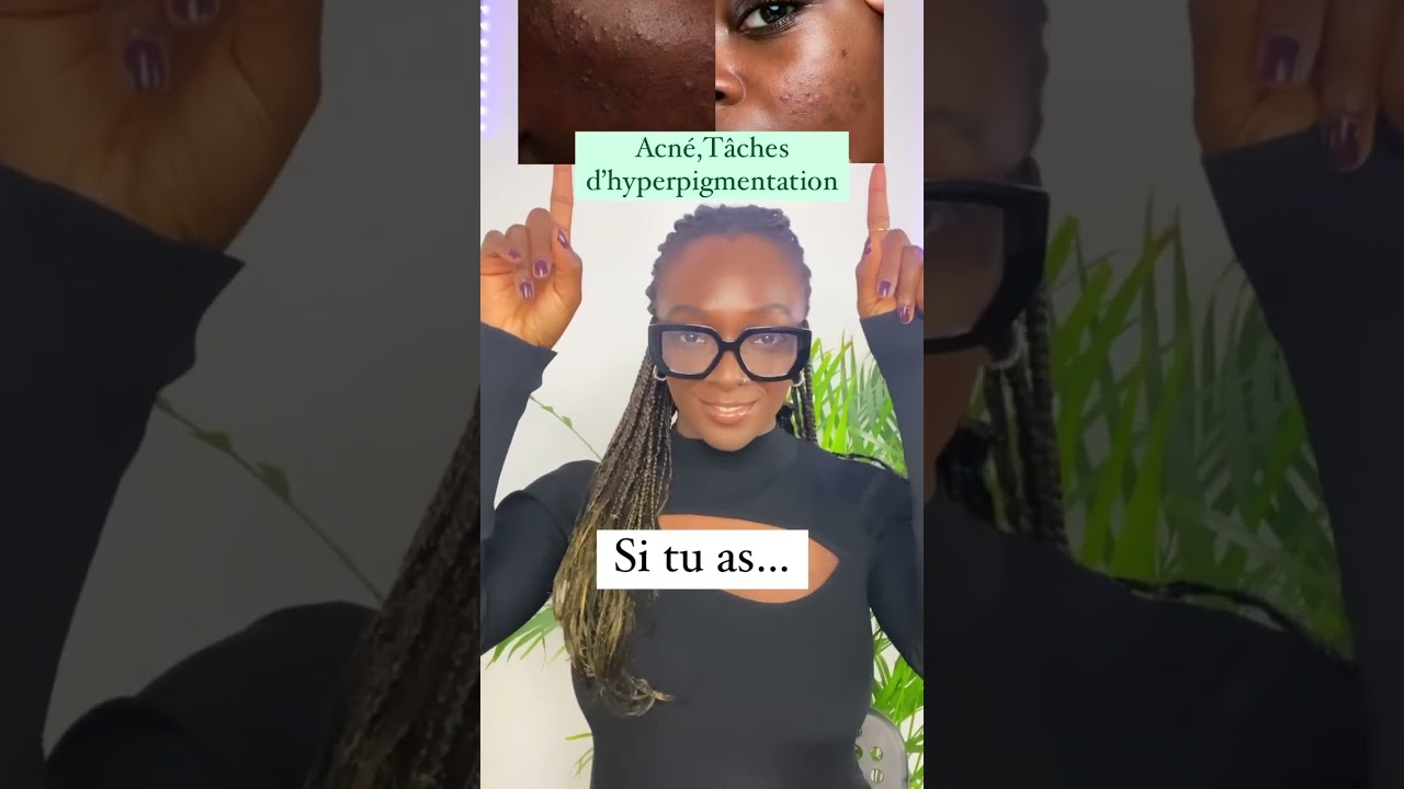 LE produit miracle pour avoir une peau lisse sans imperfections 💕Pore dilat&eacute;s, points noirs #shorts