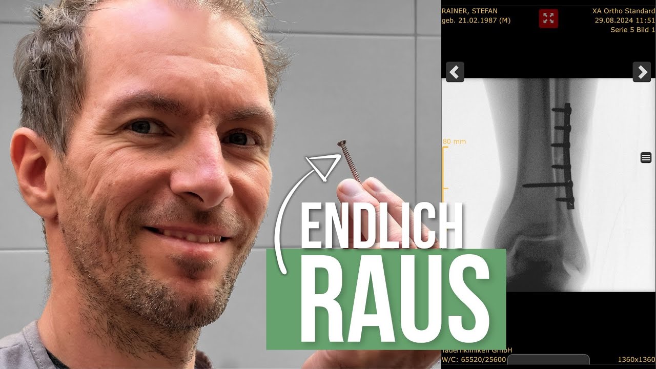 Nach 7 Wochen endlich wieder belasten
