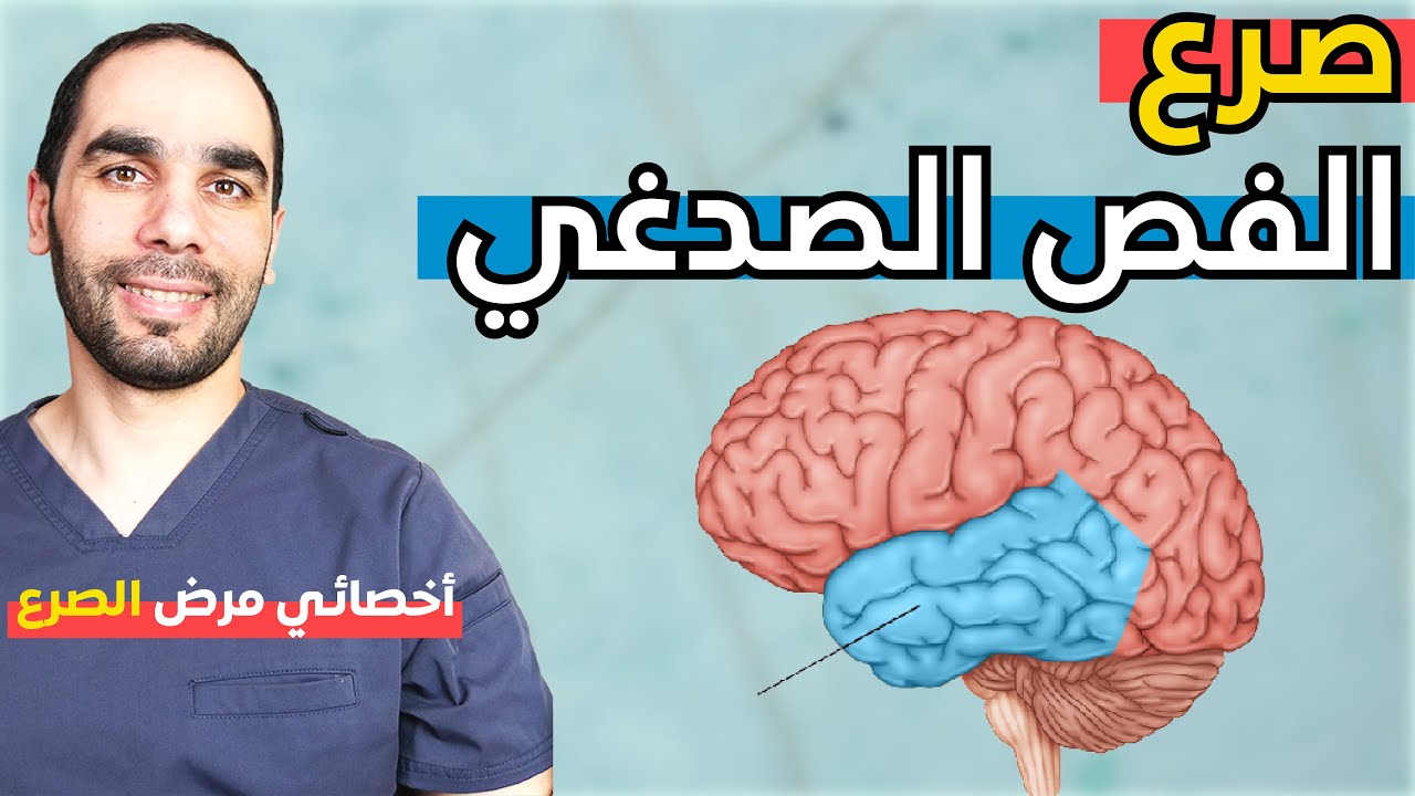 صرع الفص الصدغي: التشخيص والعلاج