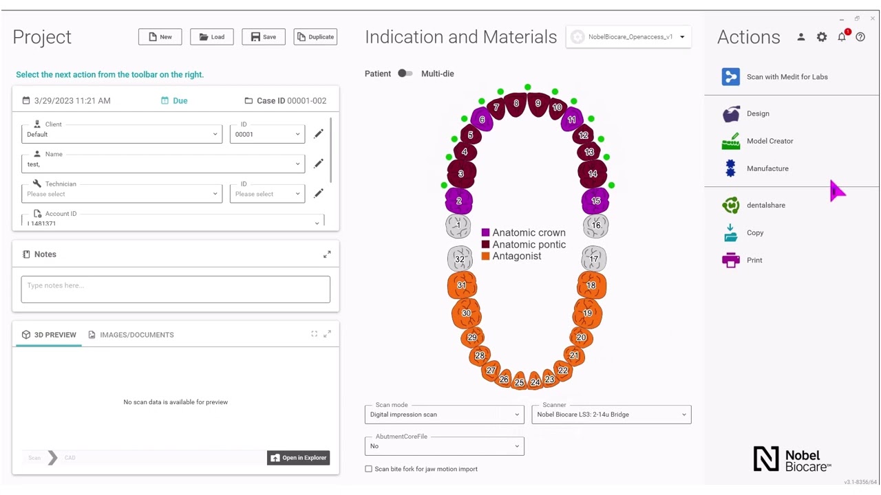 How to set up your NobelProcera® Full-contour Zirconia Implant Bridge case using exocad™