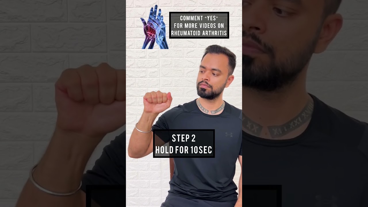 Hand Rheumatoid Arthritis