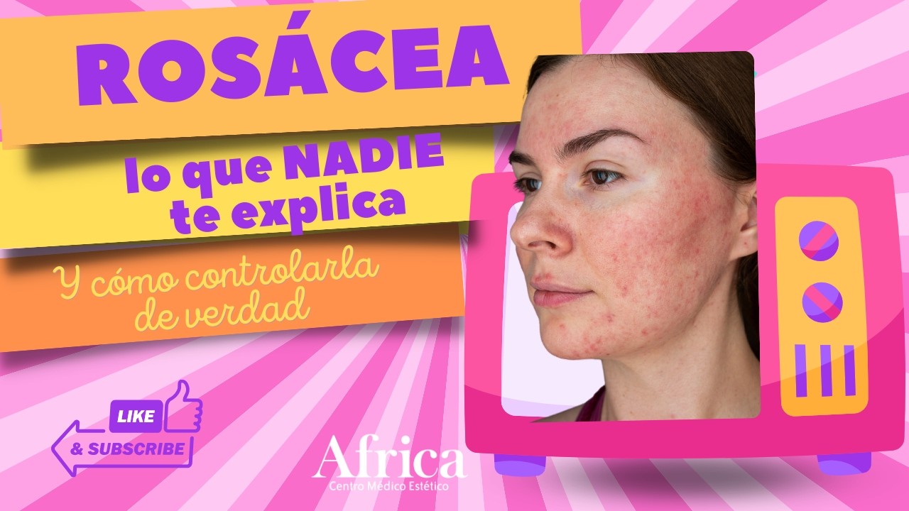 LA ROSACEA TV