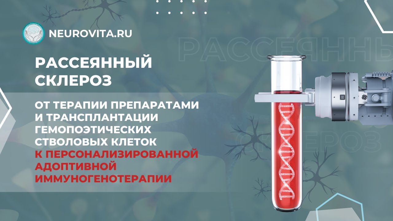 Рассеянный склероз