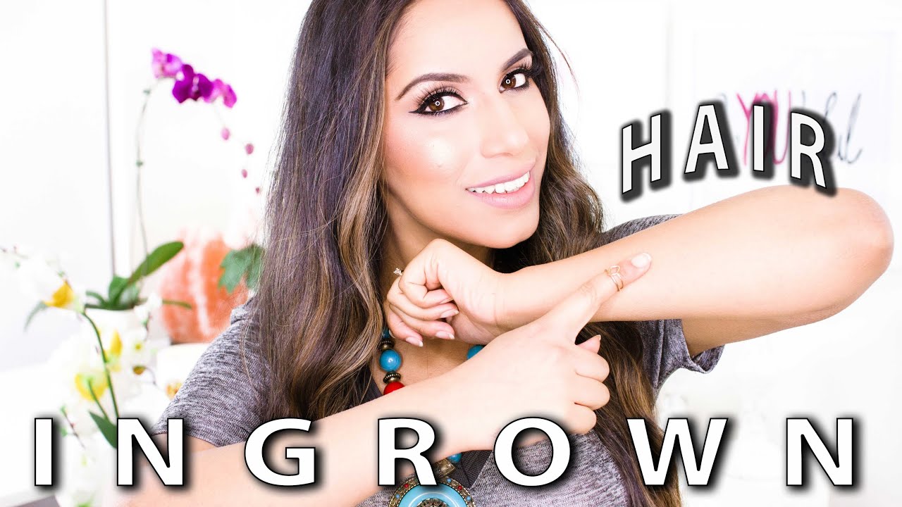 Ingrown Hair (DIY) How to Get Rid of Ingrown Hairs Step-by-Step (Natural Skin Care) 