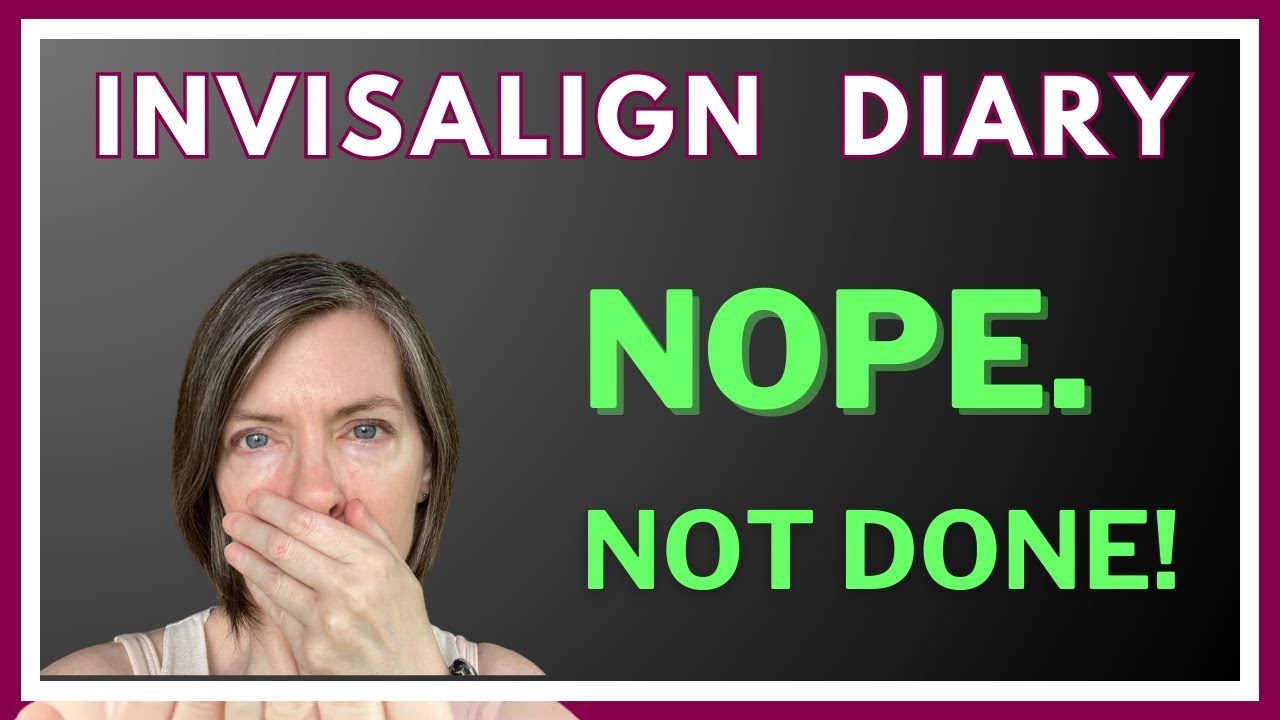 Invisalign 2 Years Later - Why I'm Not Done