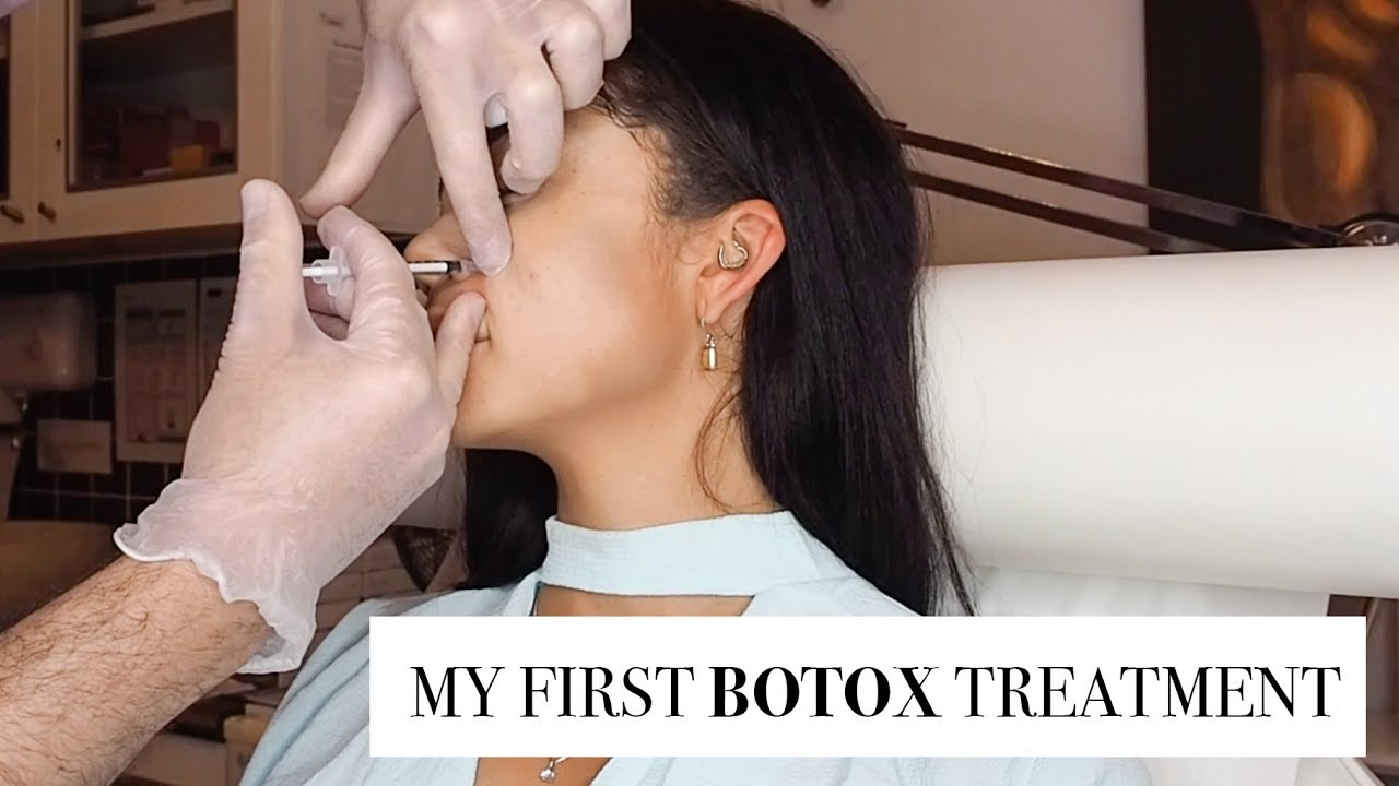 I GOT MY FIRST BOTOX TREATMENT AT 25