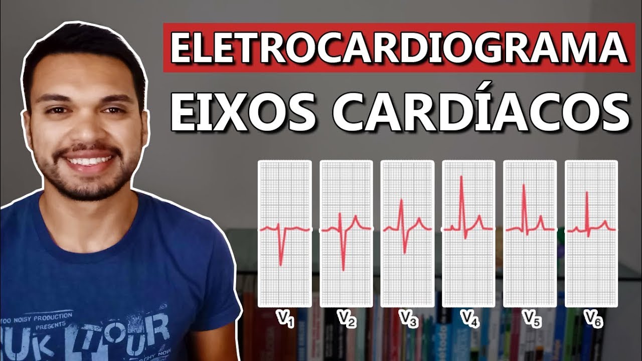 ECG l Eixos e Vetores [Cardio 05]