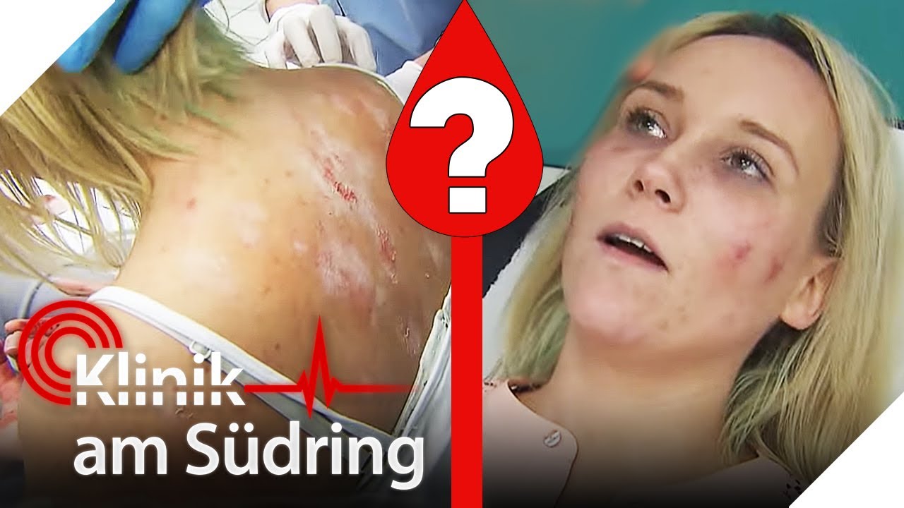 Von Blut & wei&szlig;en Flecken: Dr. Fischer r&auml;tselt an schweigsamer Patientin | Klinik am S&uuml;dring | SAT.1