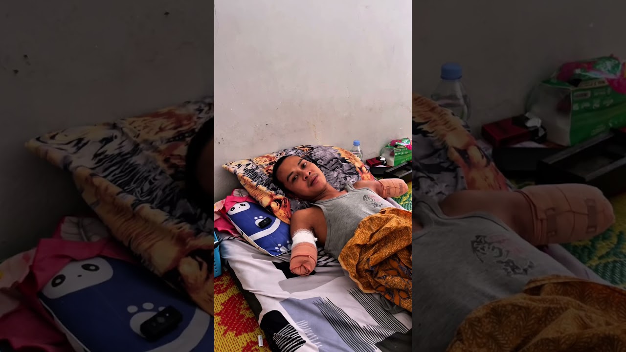 Mang sulo tersengat listrik, kedua tangannya harus di potong