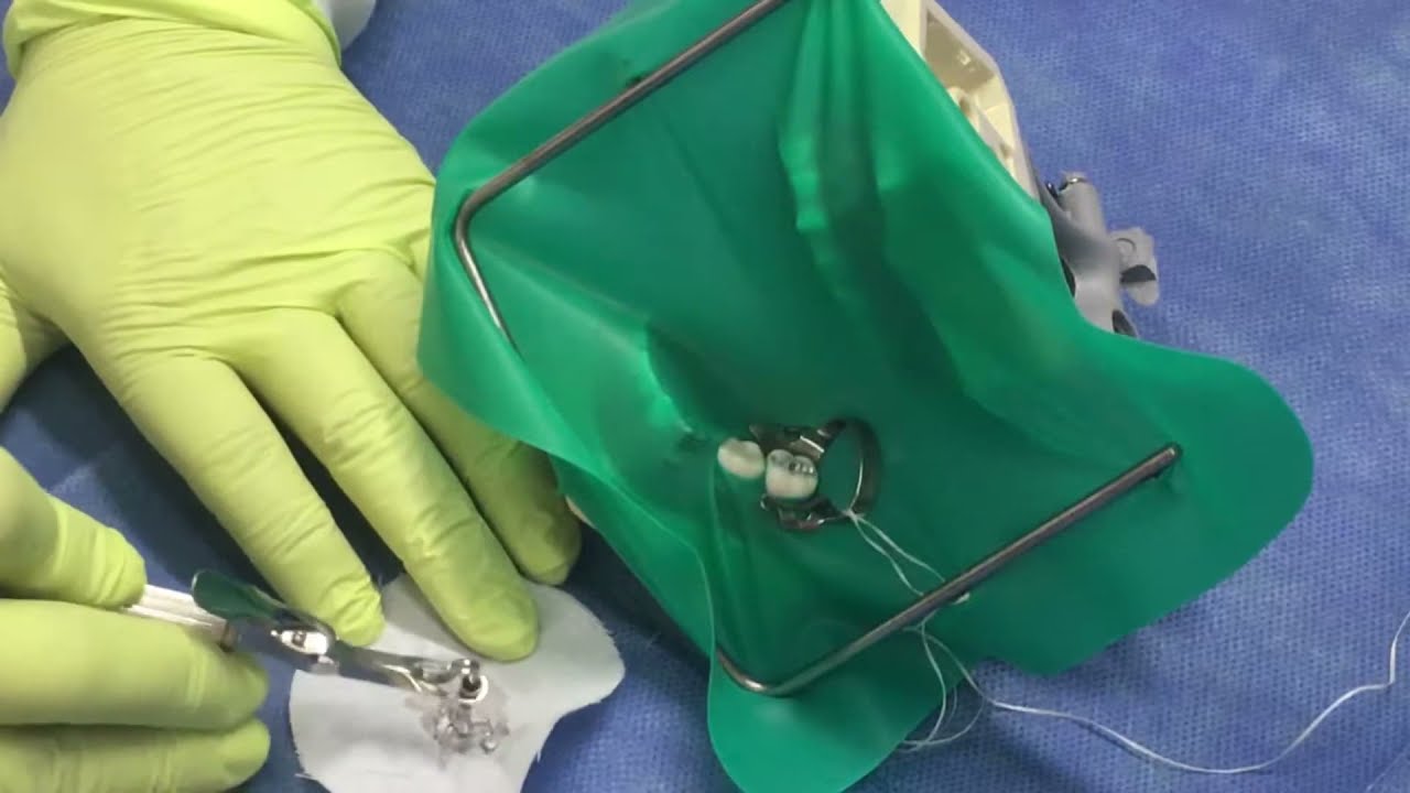 Procedimiento básico para la preparación de amalgama  Unidad VI