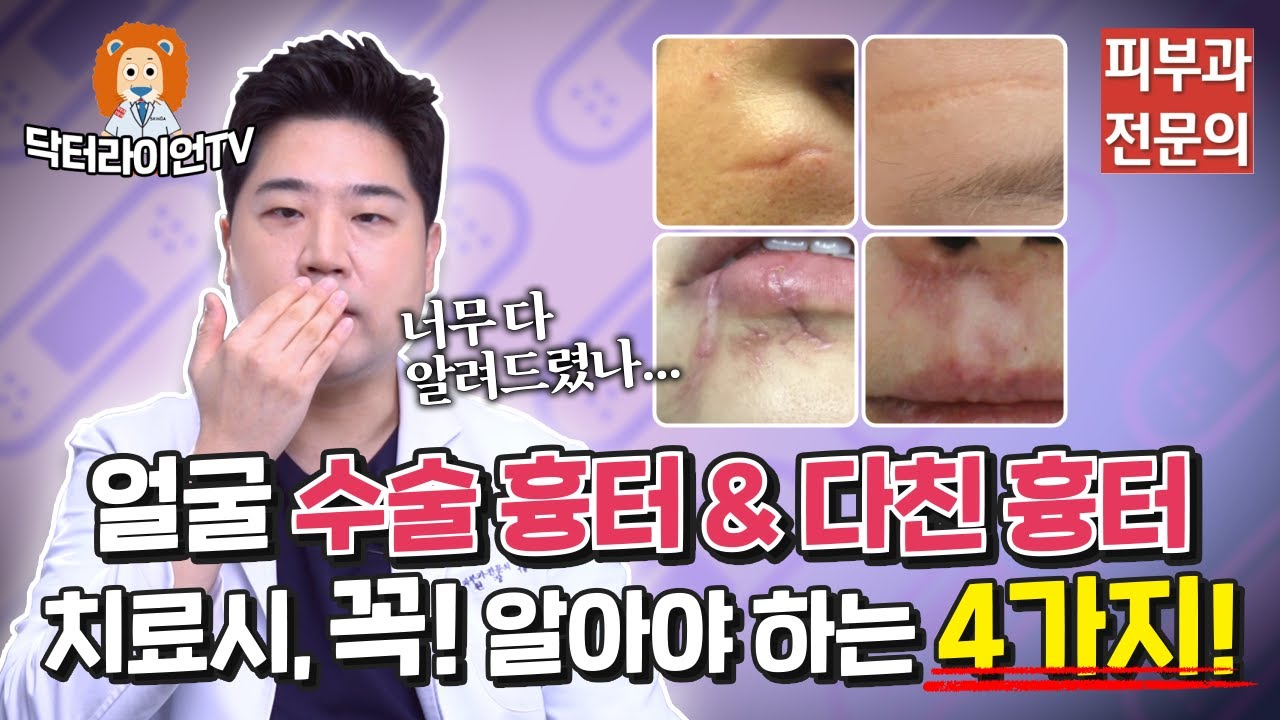 얼굴에 있는 수술·패인·봉합 흉터의 올바른 레이저 치료법과 반드시 알아야 할 4가지!